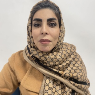 کاشت ابرو