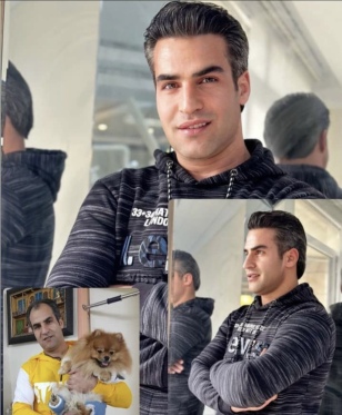 کاشت مو